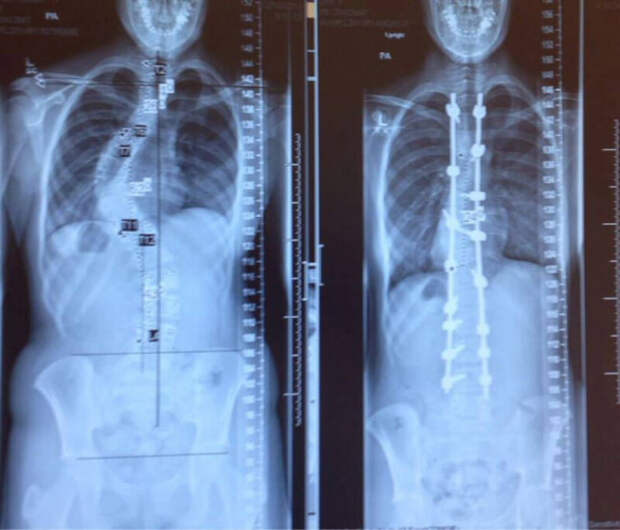 фотографии, меняющие представления о мире 