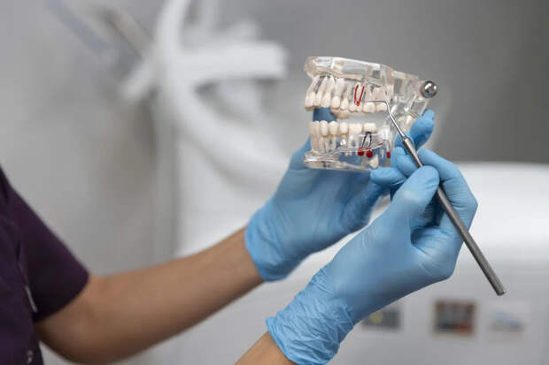 Итальянские стоматологи попали в тюрьму за удаление 11 здоровых зубов пациентке