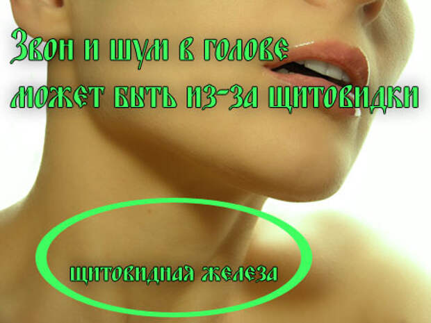 Щитовидная железа Щитовидная железа