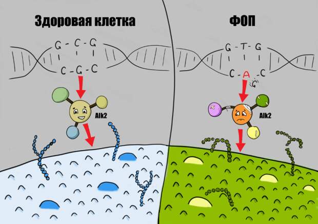 Рис. 4. Процесс образования рецепторного белка Alk2 в норме и при ФОП: замена нуклеотида гуанина (G) на аденин (А) влечёт образование мутантного рецепторного белка Alk2, из-за чего кость образуется там, где её быть не должно