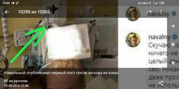 Что не так с фотографией вышедшего из комы Навального? (ФОТО) | Русская весна