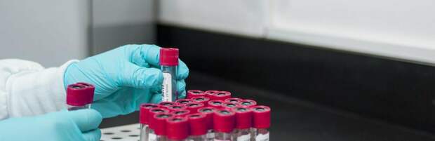 Алматы находится на 6 месте по заболеваемости ВИЧ в Казахстане