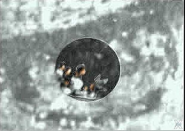 В микроскоп офтальмологи разглядели и...