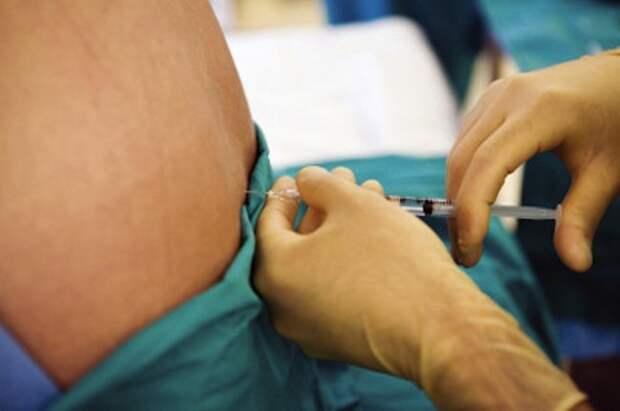 Ventajas-y-desventajas-de-la-anestesia-epidural