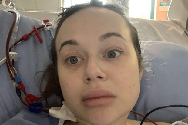 LADBible: в Канаде женщина едва не лишилась ног, уснув в неудобной позе