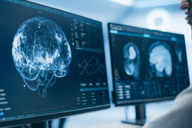 Science Focus: мозг мужчин стареет гораздо быстрее, чем у женщин