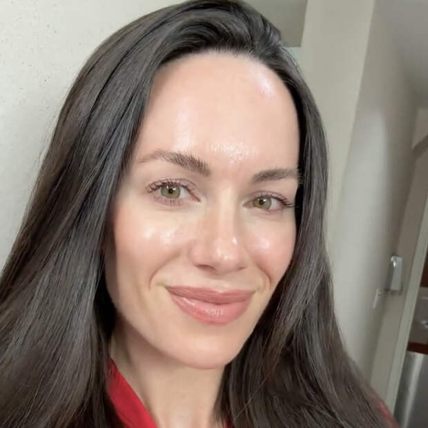 В сети восхитились внешностью косметолога после удаления филлеров