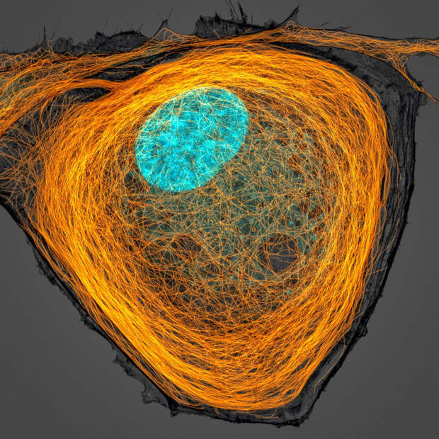 Победители конкурса микрофотографий Nikon Small World 2020