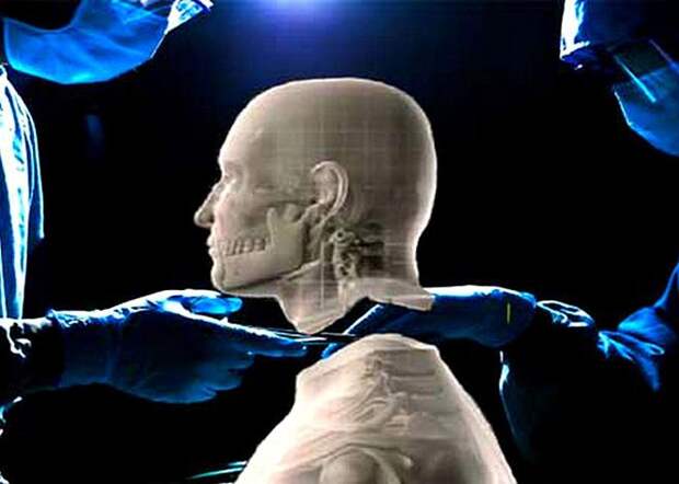 Через 10 лет человеку смогут пересаживать голову пересадка головы