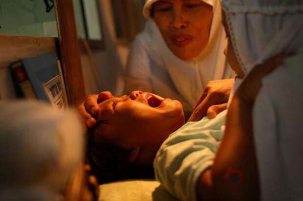 Обрезание девочек в Индонезии