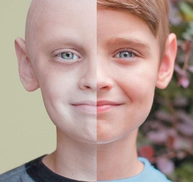 Мальчик, который победил рак   Случайные фотографии, история, факты