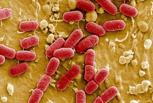 kislotoustoichivye_saprofity_tuberkulez