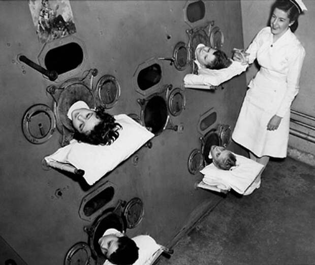 3. Аппарат "Железные легкие", 1937 год медицина, прошлое
