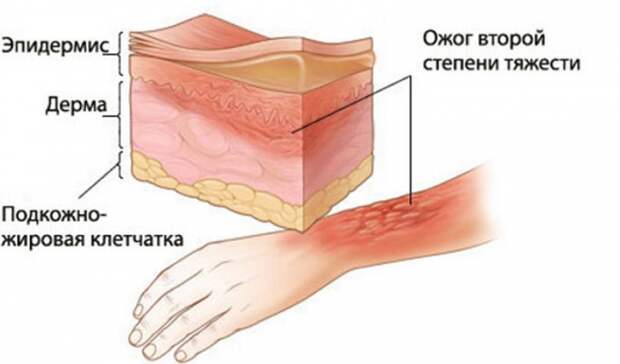 5 самых сильных болей, которые может испытать человек