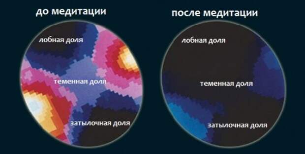 calming-mind-brain-waves