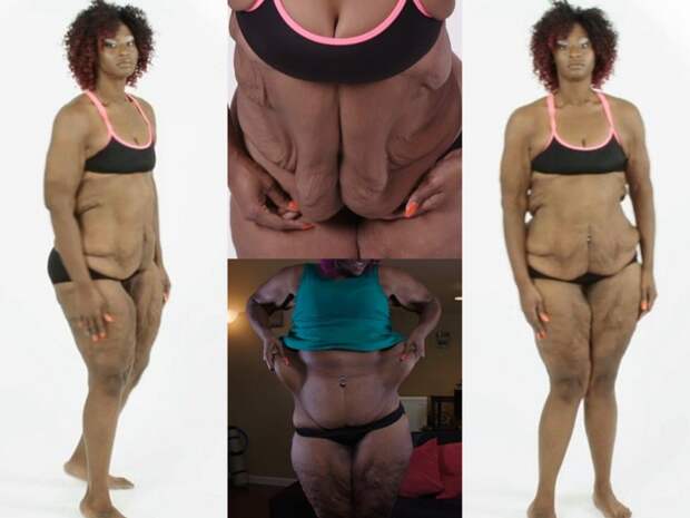 Как выглядит женщина, похудевшая на 100 кг 100 kg, женщина, похудевшая