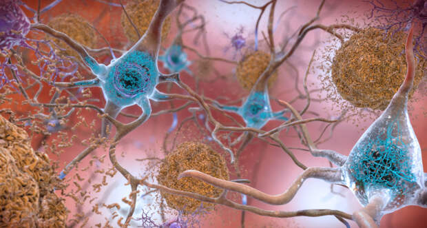 Amyloid-beta illustration