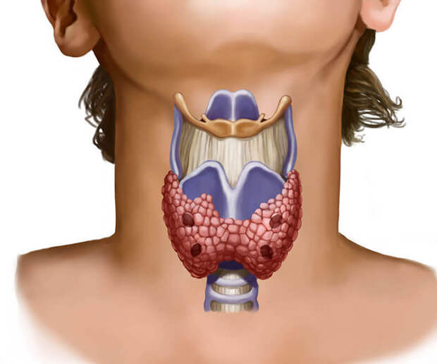 12 признаков того, что надо проверить щитовидную железу. Скрытый враг — гипотиреоз…