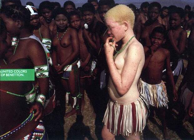 Тяжёлая жизнь африканских негров-альбиносов