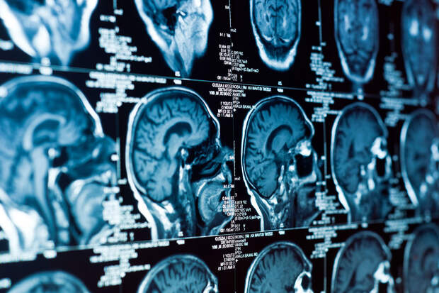 NatNeuroSci: новый препарат замедляет развитие болезней Паркинсона и Альцгеймера