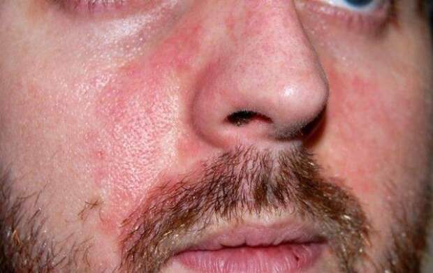 alc-11.jpg alc11jpg