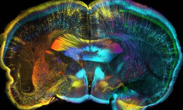 Мозг мыши во фронтальной проекции: вид на разрезе при делении на переднюю и заднюю половины.