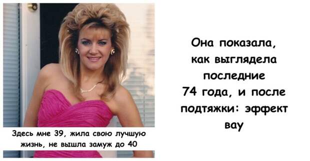 Она показала, как выглядела последние 74 года, и после подтяжки: эффект вау