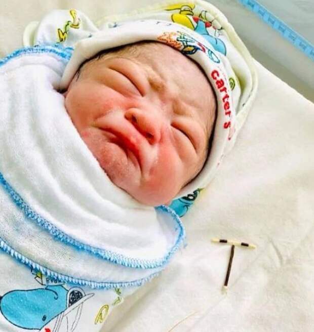 Во Вьетнаме родился малыш, который держал в руках противозачаточную спираль