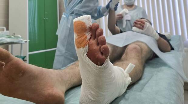 Петербуржец может лишиться части ноги из-за веселой вечеринки с друзьями