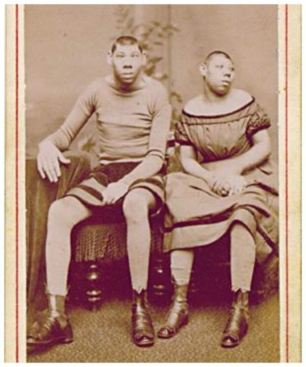 В 19 веке эти фотографии продавались как открытки. Можно было послать родственникам весточку... исторические снимки, странности, страшно, фото, цирк уродов