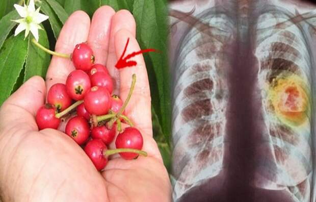 not-everyone-knows-that-aratilis-kerson-fruit-or-muntingia-can-do-this-to-your-health