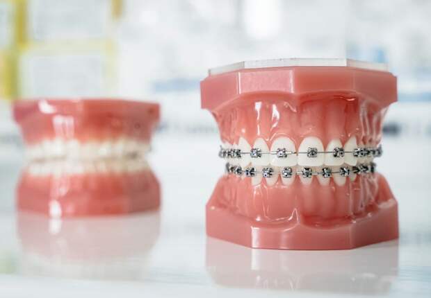 Почему у наших предков зубы росли ровнее, чем у нас