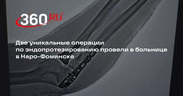Две уникальные операции по эндопротезированию провели в больнице в Наро-Фоминске