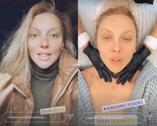 Оля Полякова до съемок новогоднего концерта