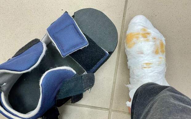 БСМП отметило снижение травматизма в новогодние выходные