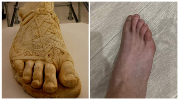 Греческая стопа: указательный - самый длинный, большой - короче указательного, а средний, безымянный и мизинец каждый короче предыдущего. Греческая стопа: указательный - самый длинный, большой - короче указательного, а средний, безымянный и мизинец каждый короче предыдущего.