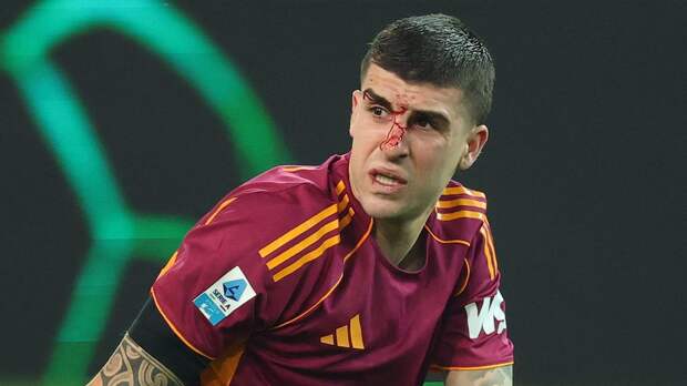 «Рома» проиграла «Удинезе» и прервала четырехматчевую серию без поражений в Серии А