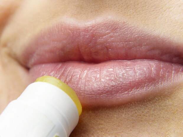 lips-3141753_1280-1024x768 Избавляемся от трещин на губах