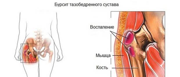 О чем говорит боль в суставах