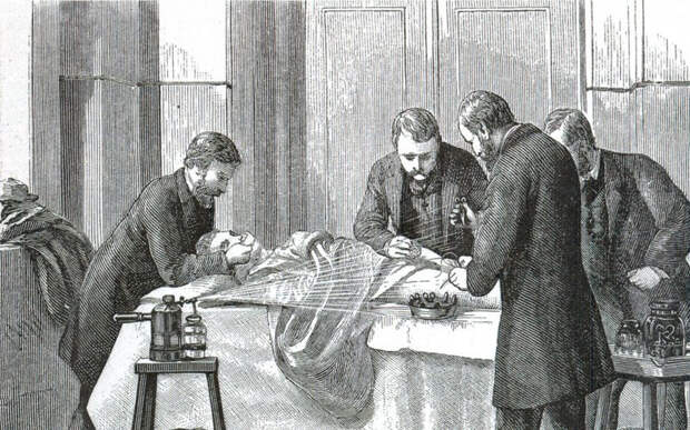 Шокирующие факты о викторианской хирургии
