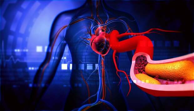 Шум от дорожного движения связан с повышением уровня холестерина и липидов