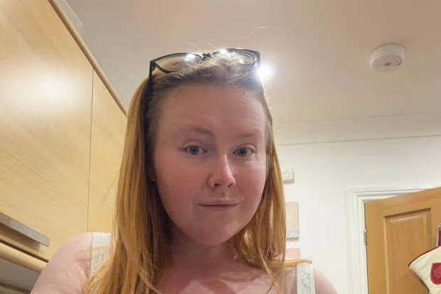 Daily Mail: грудь британки выросла в несколько раз после попытки похудеть