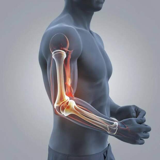 Исследование локтевого сустава методом магнитно-резонансной томографии