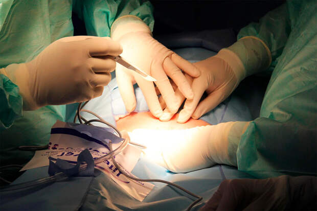 В Ростове-на-Дону врачи удалили у пациентки гигантскую опухоль щитовидной железы