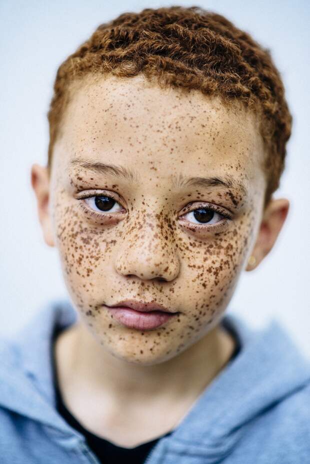 Фотограф Мишель Маршалл сделала портреты рыжеволосых людей с веснушками, чтобы разрушить стереотипы