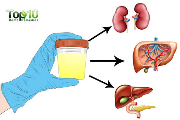 feat-urine-color-tells-heal