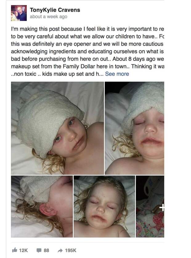 Маленькая девочка попала в больницу с кровавыми ранами после, казалось бы, безобидной игрушки. Родители, будьте бдительны!