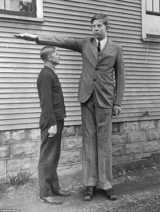 Роберт в возрасте 13 лет рядом со своим отцом Гарольдом акромегалия, великан, опухоль, рекорд, рекорд гиннесса, рекордсмен Гинесса, самый высокий, самый высокий человек