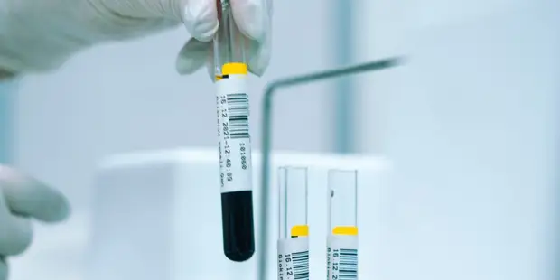 Хорошие новости: учёные создали тест, помогающий оценить риск сердечно-сосудистых заболеваний