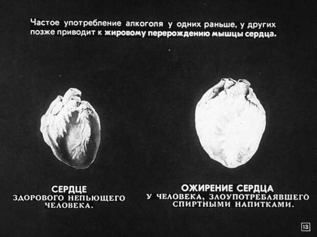 Алкоголизм и борьба с ним. Диафильм
